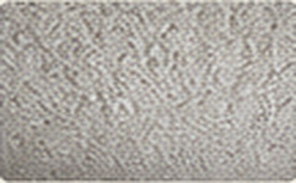 Popcorn Ceilings